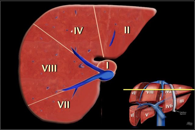 Image at the level of the superior liver segments.